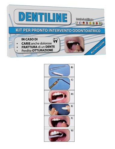 DENTYLINE PASTE 2G + LIQ 1G